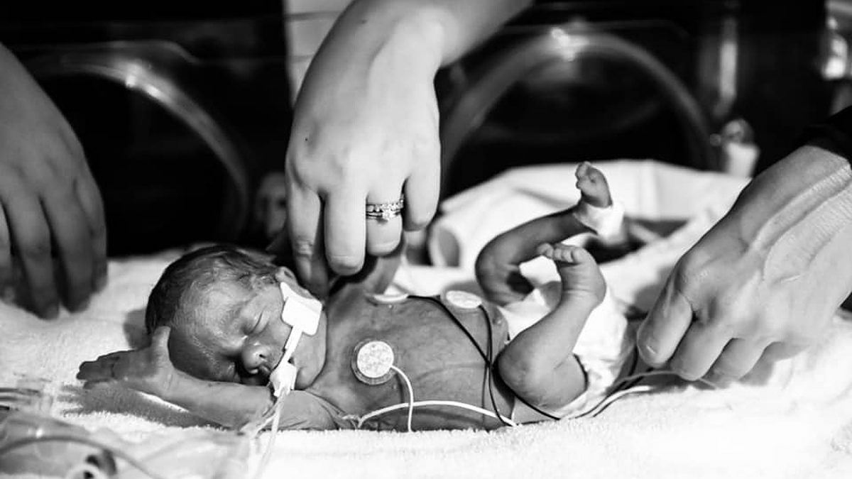 This micro-preemie beating the odds is a true Christmas miracle